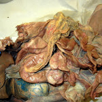 duodenum.JPG