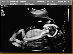 baby boy scan 1