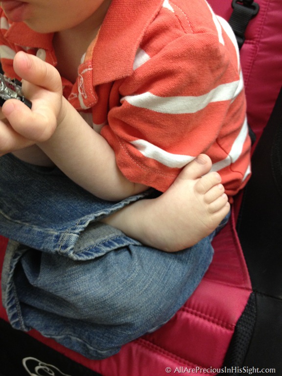 [Cooper%2520clubfeet%2520visit%2520077%255B3%255D.jpg]