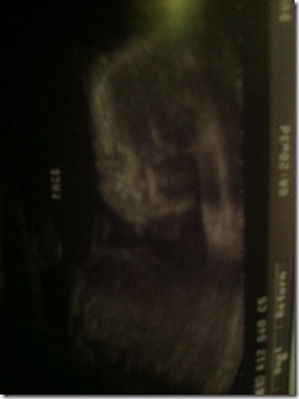 Ultrasound March 6 face