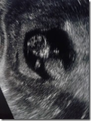 Baby 8 Baby 8