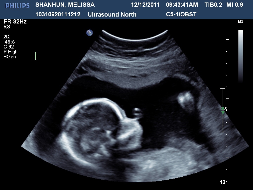 [SHANHUNMELISSA20111212094341278%255B2%255D.jpg]