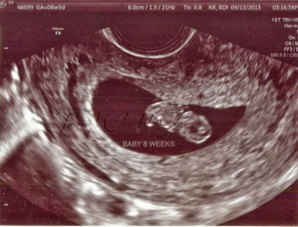 Baby-3-9weeks-1blog.jpg