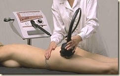 liposuccion_ultrasonica