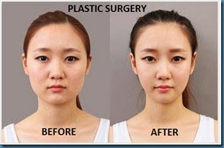 PLASTIC SURGERY PLASTIC SURGERY