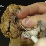 brain_dissect10.jpg brain_dissect10.jpg