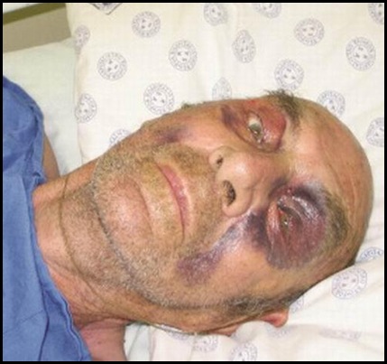 POTTIE POTGIETER WINBURG WELKOM LEFT FOR DEAD 5 BL ATTACKERS WINBURG JAN182012