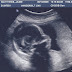 Pregnancy Album