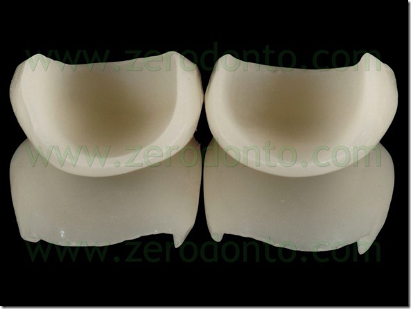 97 veneers ceramica vetrosa