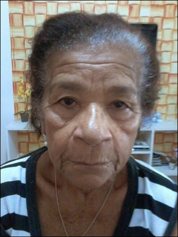 Antes Antes