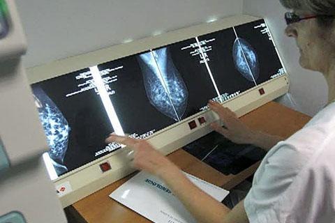 [new_breast_cancer_treatment_480_16dec2011%255B2%255D.jpg]