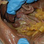 rat_kidney_revealed.JPG