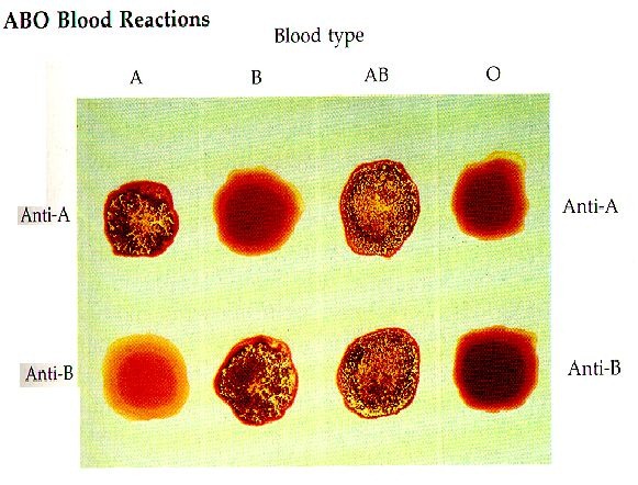 [17-abo-blood-test3.jpg]
