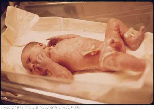 'Newborn Child in the Delivery Room of Loretto Hospital in New Ulm, Minnesota...' photo (c) 1975, The U.S. National Archives - license: http://www.flickr.com/commons/usage/