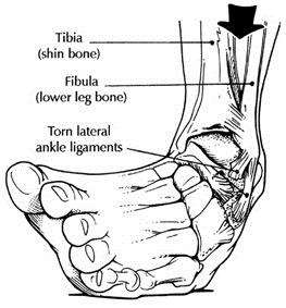 [ankle%255B10%255D.jpg]