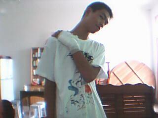 受伤了还能摆pose