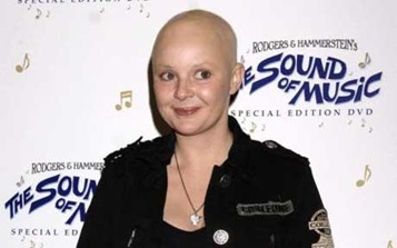 The-bald-facts-about-female-hair-loss