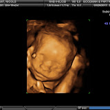 Its A Girl!