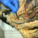 esophagus_probe_L.JPG