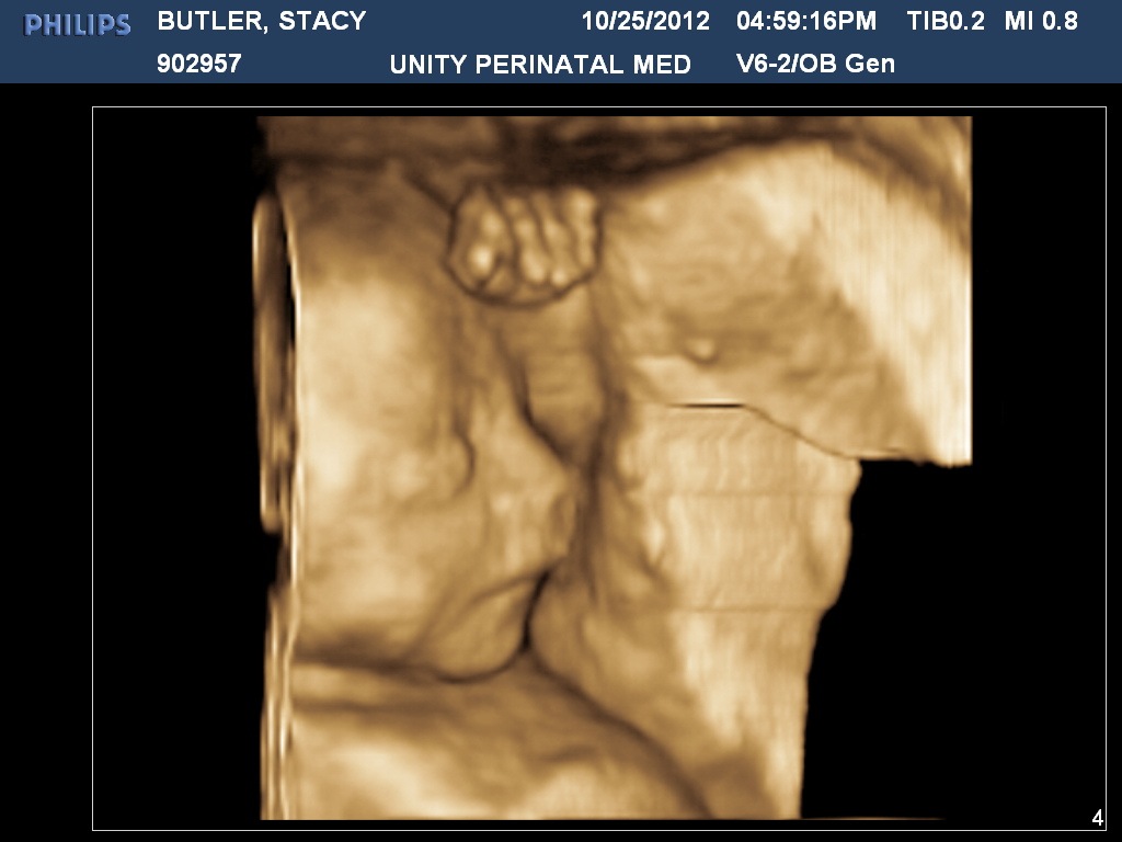 [BUTLERSTACY20121025165916875%255B3%255D.jpg]