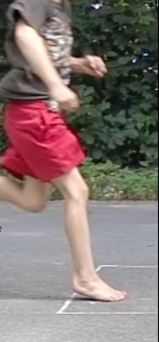 [Anders%2520Forefoot%25201%255B6%255D.jpg]