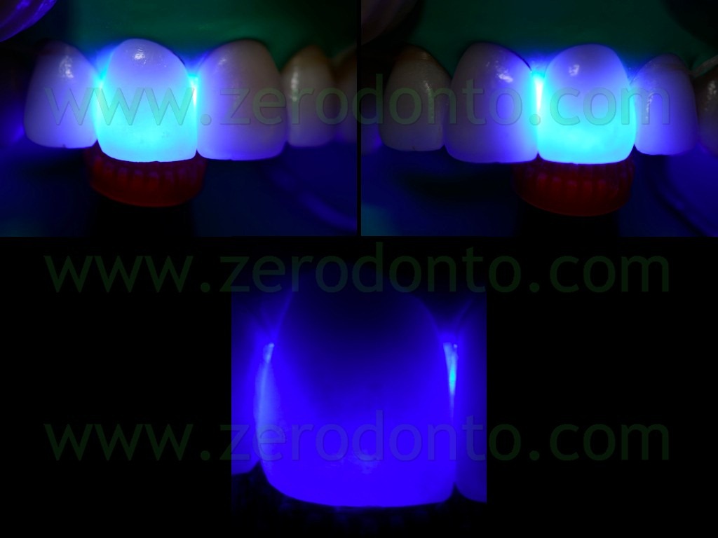 [118-transilluminazione-luce-alogena-%255B2%255D.jpg]