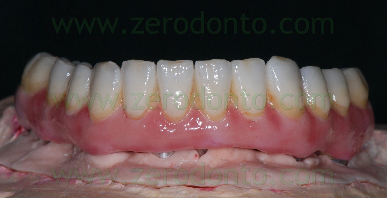 [zirconia-ceramica2.jpg]