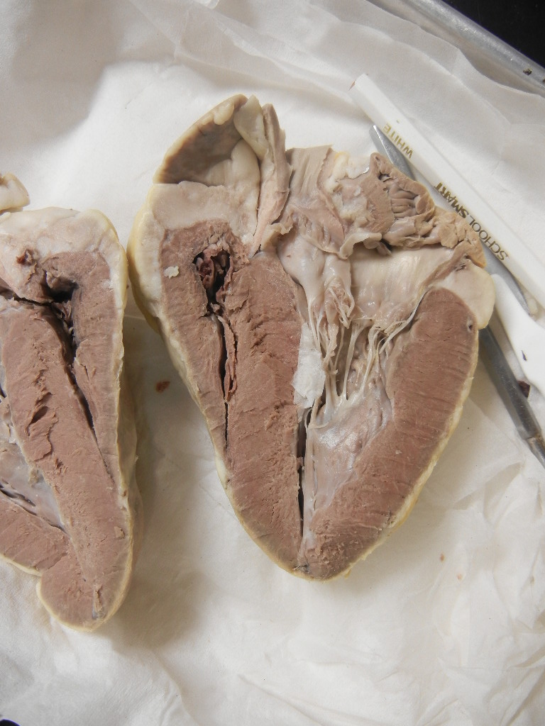 Sheep Heart Dissection | AnatomyCorner