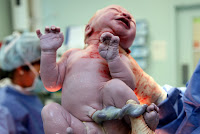 Our very first look at Oscar!