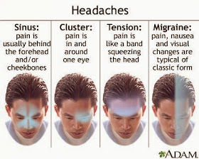 Blogger S Sansar A Blog From Nepal 7 Home Remedies For Headache Migraines