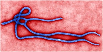 [ebola_virus%255B3%255D.jpg]