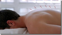 acupuntura curitiba lombalgia