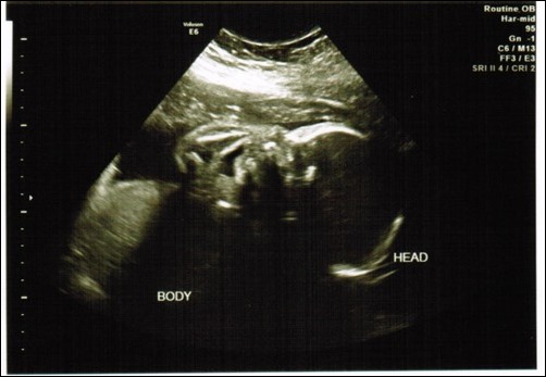 head and body ultrasound head and body ultrasound