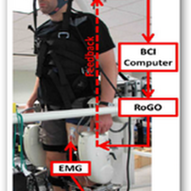 Long Beach Veterans Medical Center Builds First Prosthetic Lower Leg Controlled in Real Time by EEG
