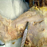 pectoantebrachialis_close.jpg