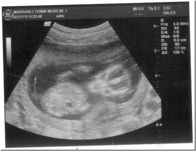 03-18-2012 12_54_41PM