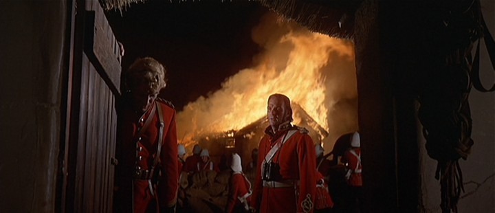 [Zulu-The-Hospital-Burns2.jpg]