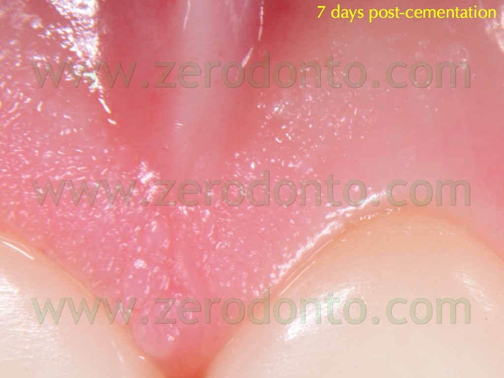 [129-precisione-adattamento-margine-v%255B1%255D.jpg]