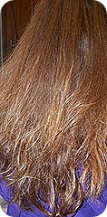 flatironexpertsbefore flatironexpertsbefore