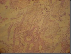 Teratoma- high resolution histology slide tsnaps Teratoma- high resolution histology slide tsnaps