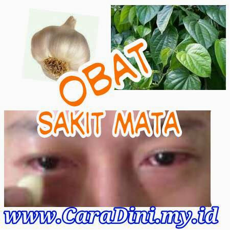 obat sakit mata alami