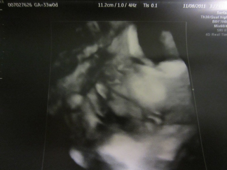 [Zoey%2520Nola%252033%2520Week%2520Sonogram4%255B6%255D.jpg]