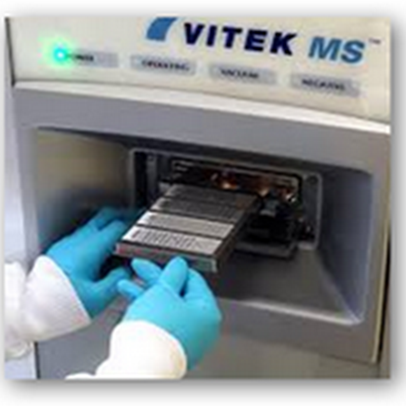 FDA Approves Mass Spectrometer System, VITEK MS That Can Identify 192 Different Tests at Once