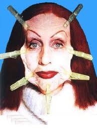 [facelift%255B5%255D.jpg]