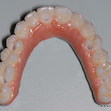 Prótesis 100% cerámica sin metal