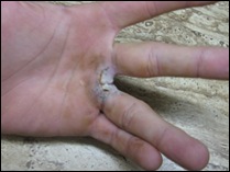 hand2