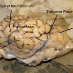 brain_dissect04.jpg brain_dissect04.jpg