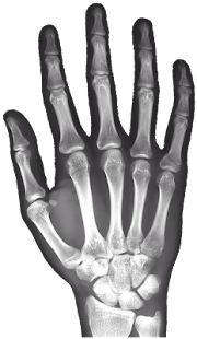 How to mod X-Ray Right Hand FREE lastet apk for laptop
