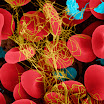 403620-Fibrin Blood Clot.jpg