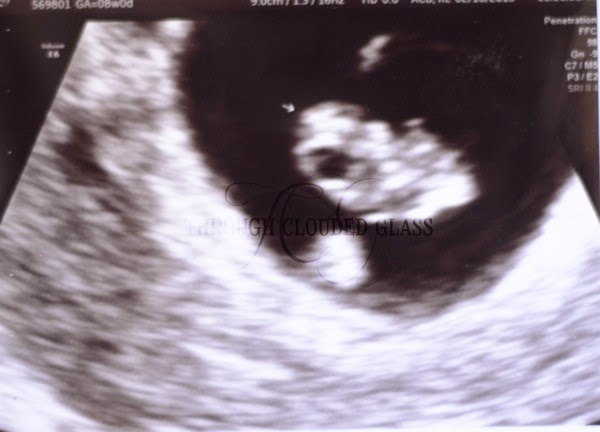 pregnant6.jpg Pregnant6